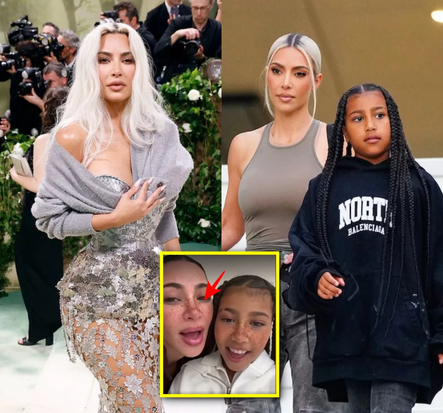 North West exposes Kim Kardashian’s real skin – pimples and all – Rap Blog